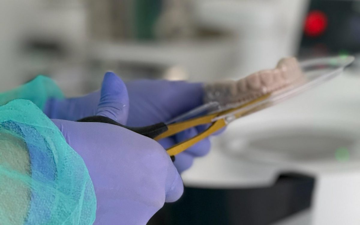 Caso Real: Periimplantitis