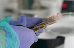 Caso Real: Periimplantitis